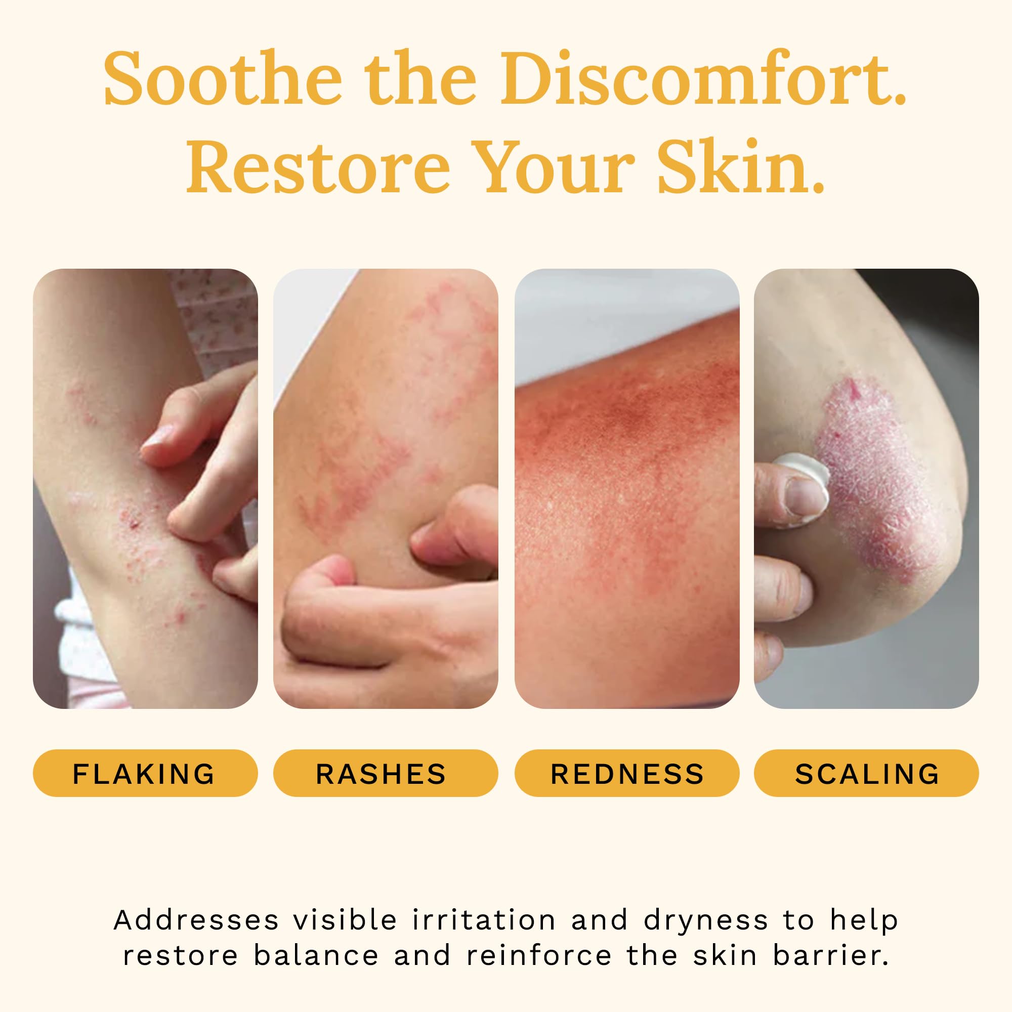 Rejuvaskin Skin Recovery Cream being applied to arm for relief