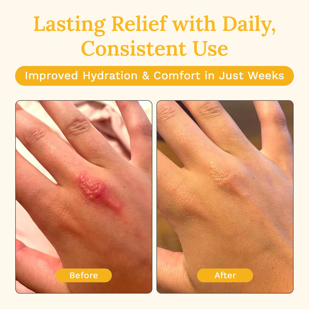 Rejuvaskin Skin Recovery Cream hydration boost on dry skin