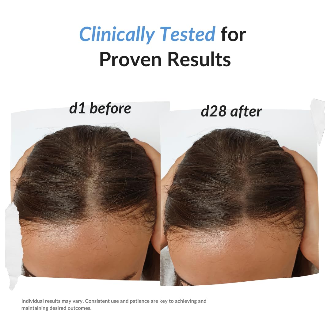 REKZE 24 Serum packaging label highlighting dermatologist-tested and sulfate-free formula.