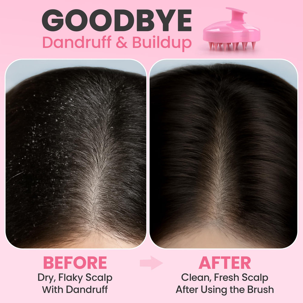 RELAXXO hair-growth scrubber shown for wet use, supporting scalp circulation and nourishment.