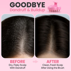 RELAXXO hair-growth scrubber shown for wet use, supporting scalp circulation and nourishment.