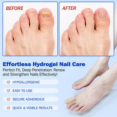ReliCo nighttime application patch ready for overnight renewal on a nail.