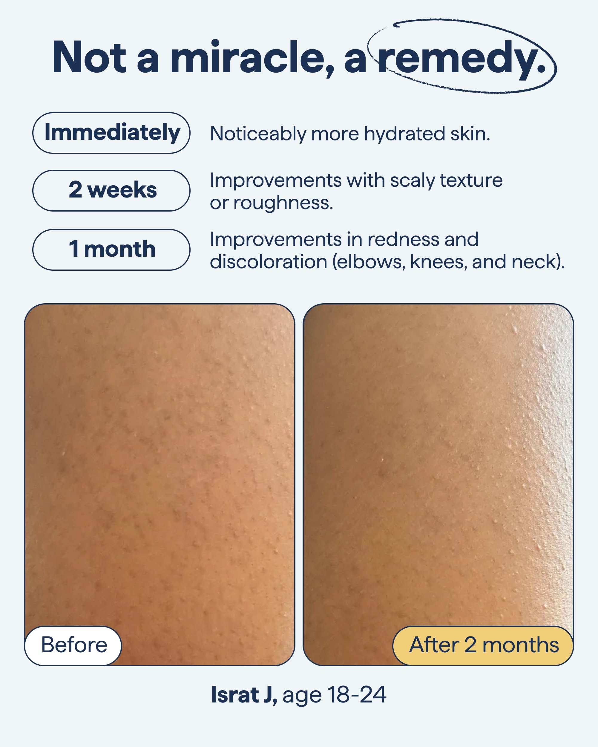 Remedy Science fragrance-free formula supports sensitive skin care routines.