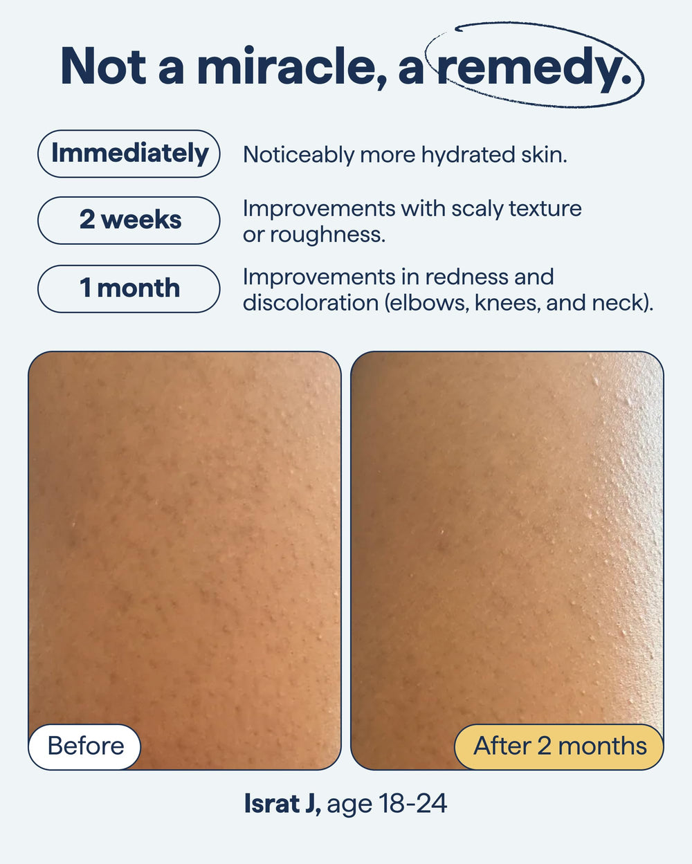 Remedy Science fragrance-free formula supports sensitive skin care routines.