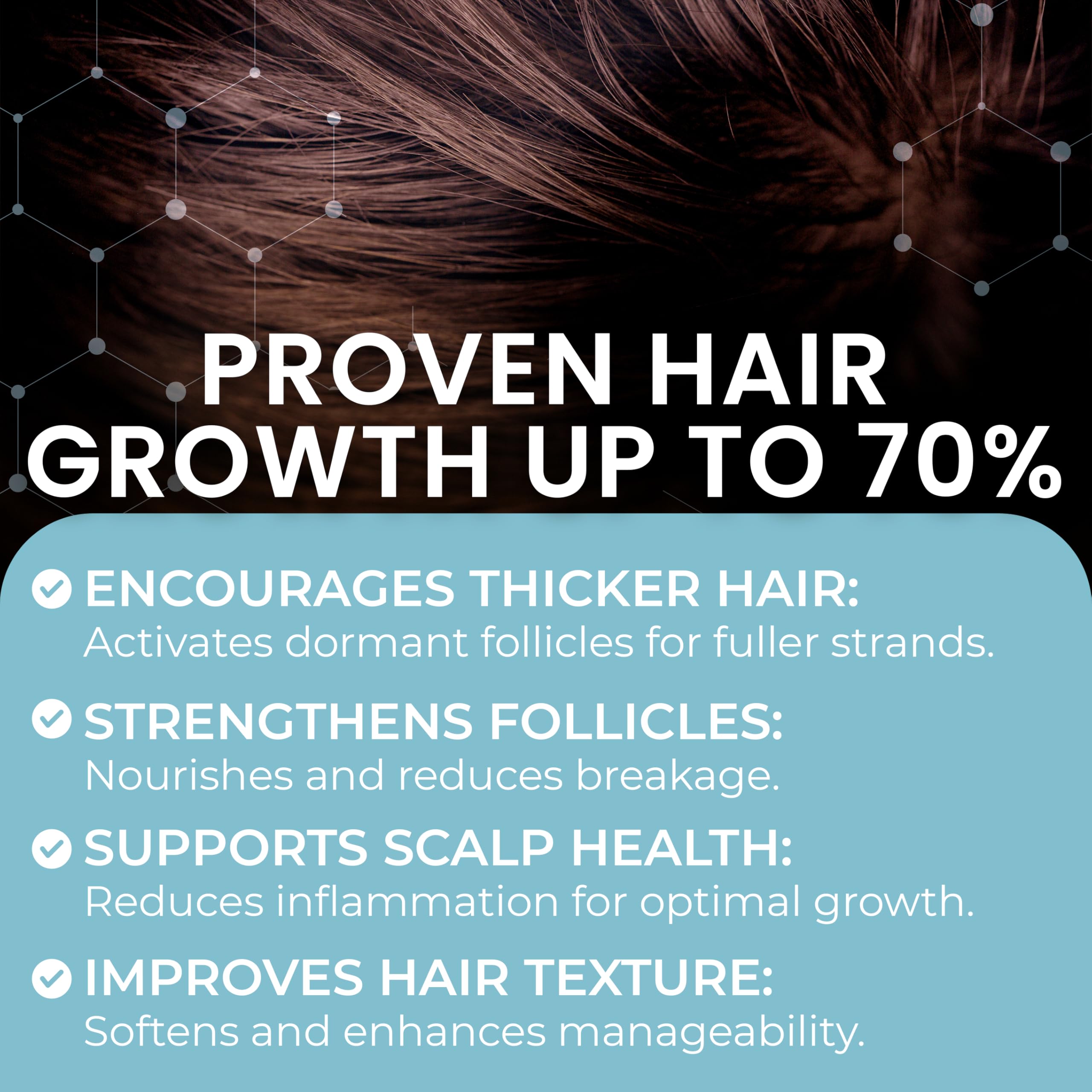 Remixidil 5% Minoxidil Foam bottle label detail emphasizes 3-month supply