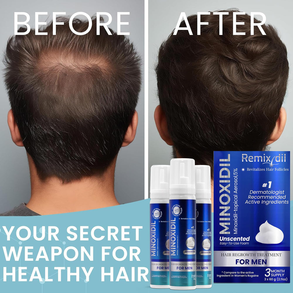 Remixidil Men’s 5% Minoxidil Foam on mirror reflects daily routine