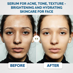 Renewa Skin AgeDefy Niacinamide Serum with hyaluronic acid application, delivering deep hydration.