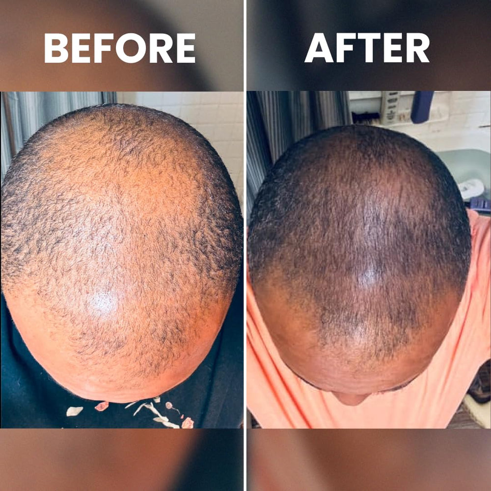 Rennora Beauty Hair Growth Serum packaging highlights 34+ natural ingredients and no chemicals