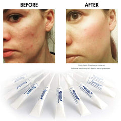 Graphic showing Rapidex Marine Exfoliator ingredients and marine actives.