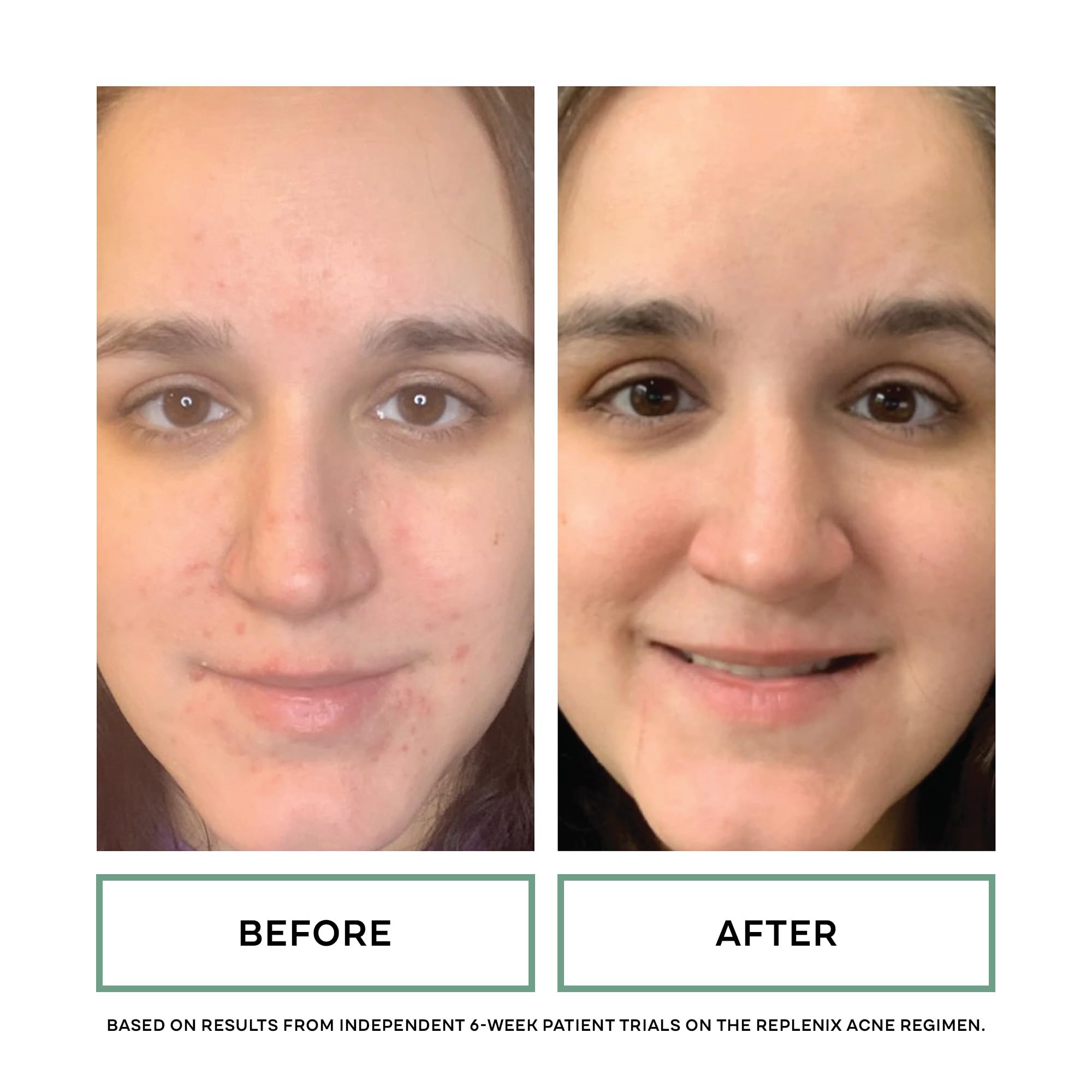 Replenix BP Acne Face Wash closeup of benzoyl peroxide active ingredient