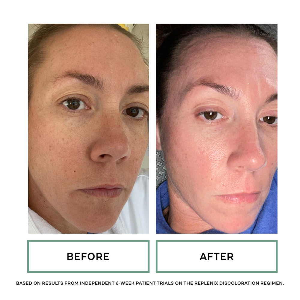 Hydrated under-eye skin with a healthy glow after application
