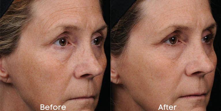 Replere night routine close-up demonstrates easy nightly use for softer morning skin