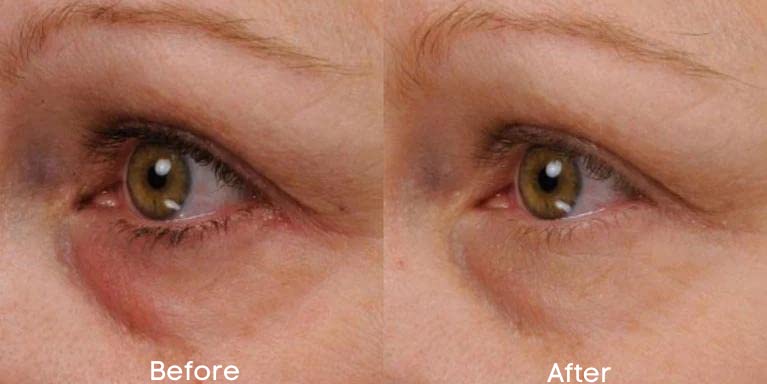 Replere Renew & Firm Eye Serum under-eye application for delicate skin care