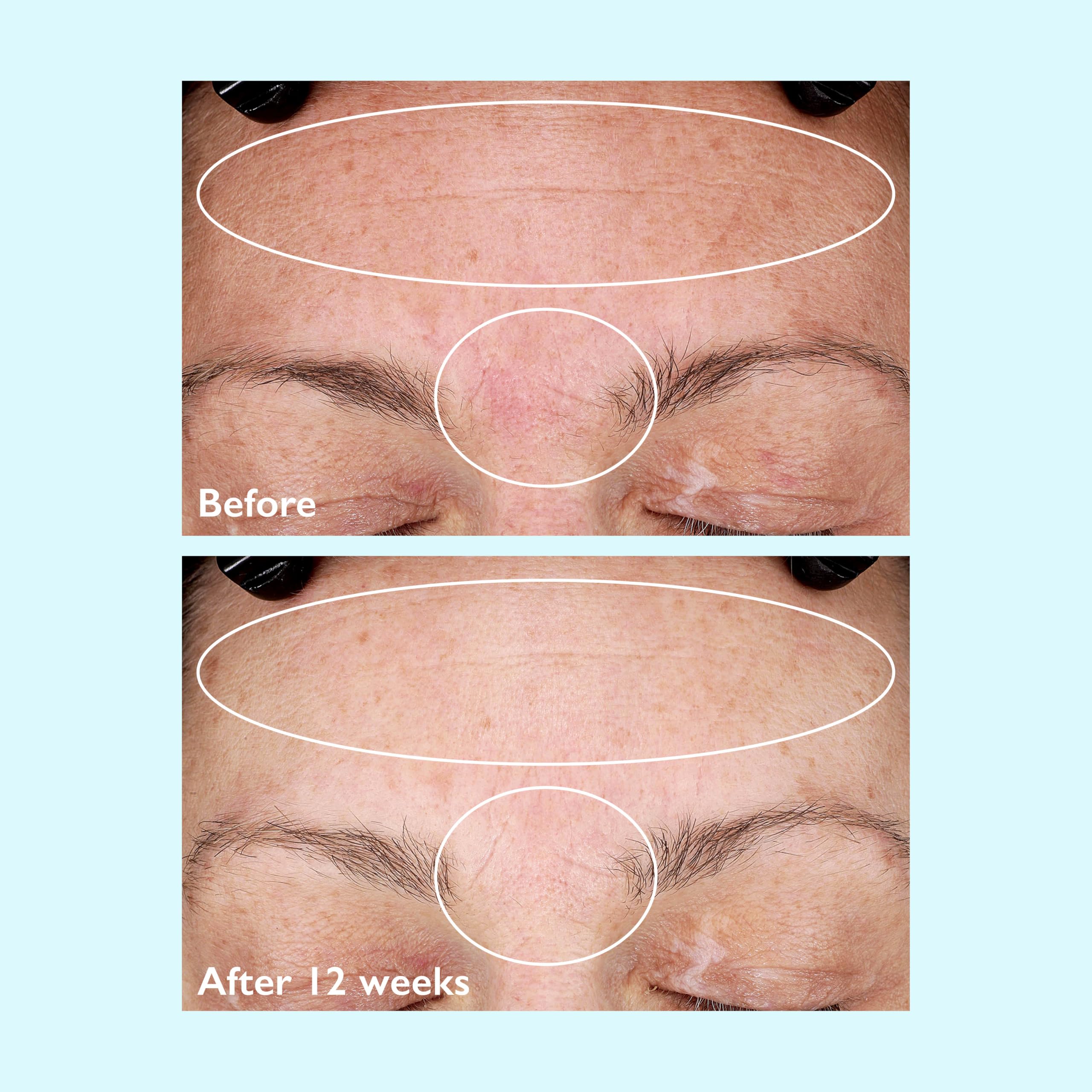 Restorsea Clinical-tested badge reinforces dermatologist-tested credibility.