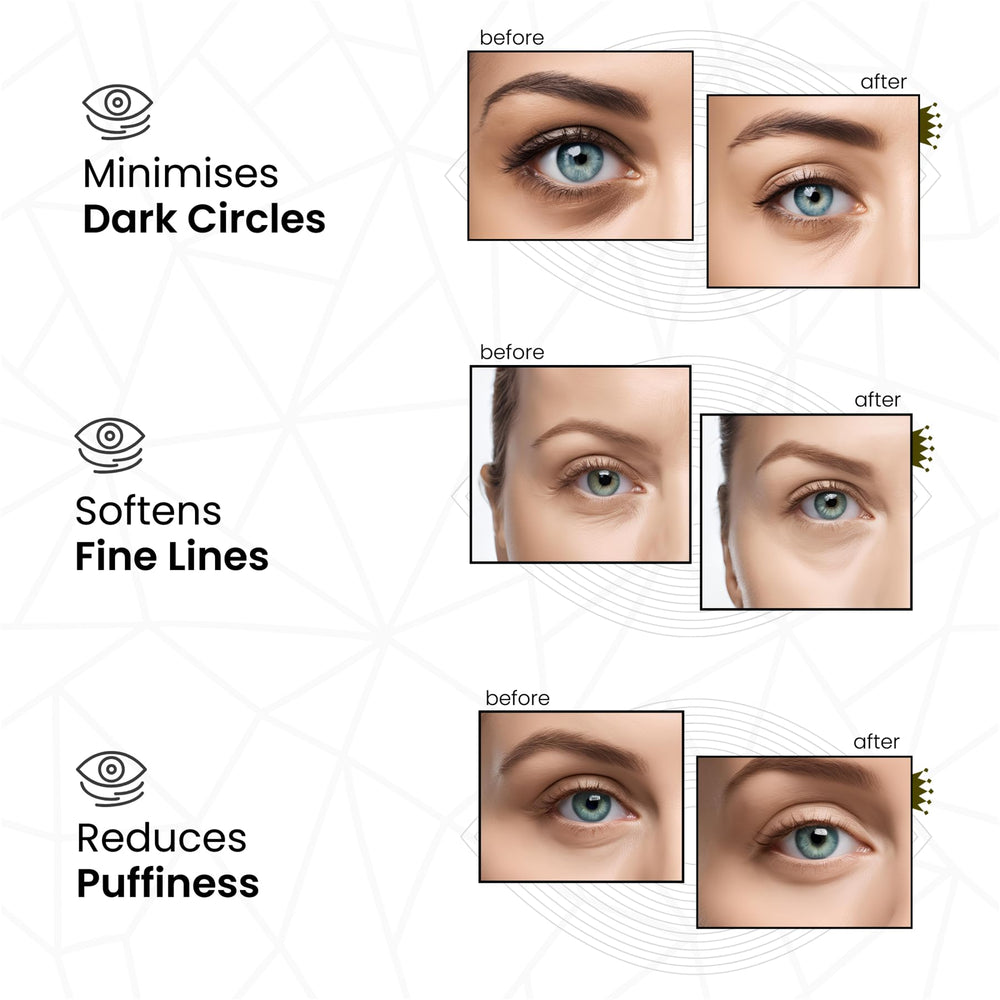Applying REVITALE Under Eye Patches shows easy, soothing use for quick self-care.
