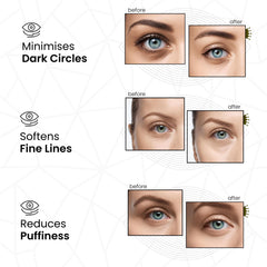 Applying REVITALE Under Eye Patches shows easy, soothing use for quick self-care.