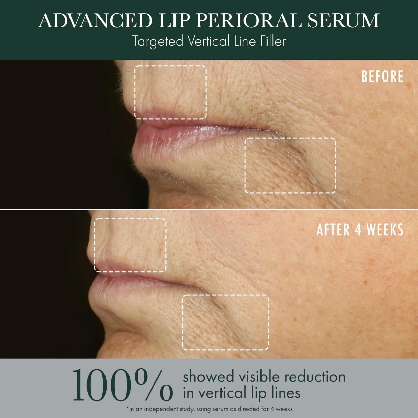 Tranexamic and brightening agents in RéVive serum targeting lip-area tone.