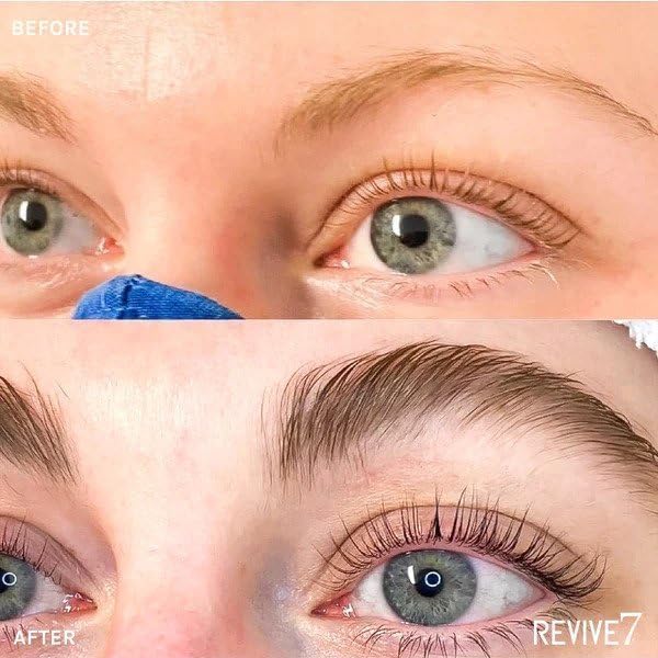 Close-up of fuller-looking lashes with Revive7 after regular use.