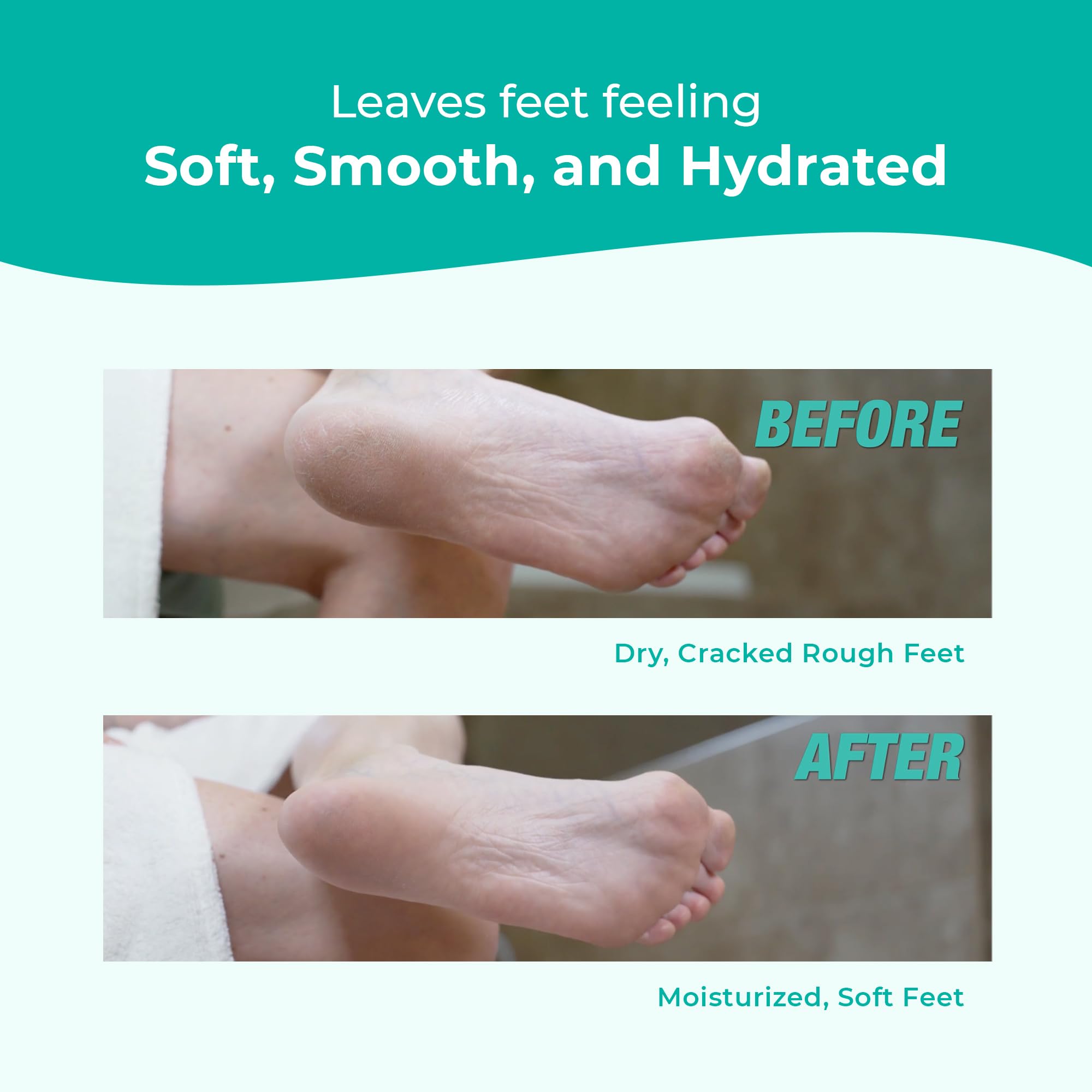 Richenna EZ Foot File used to gently remove dead skin.