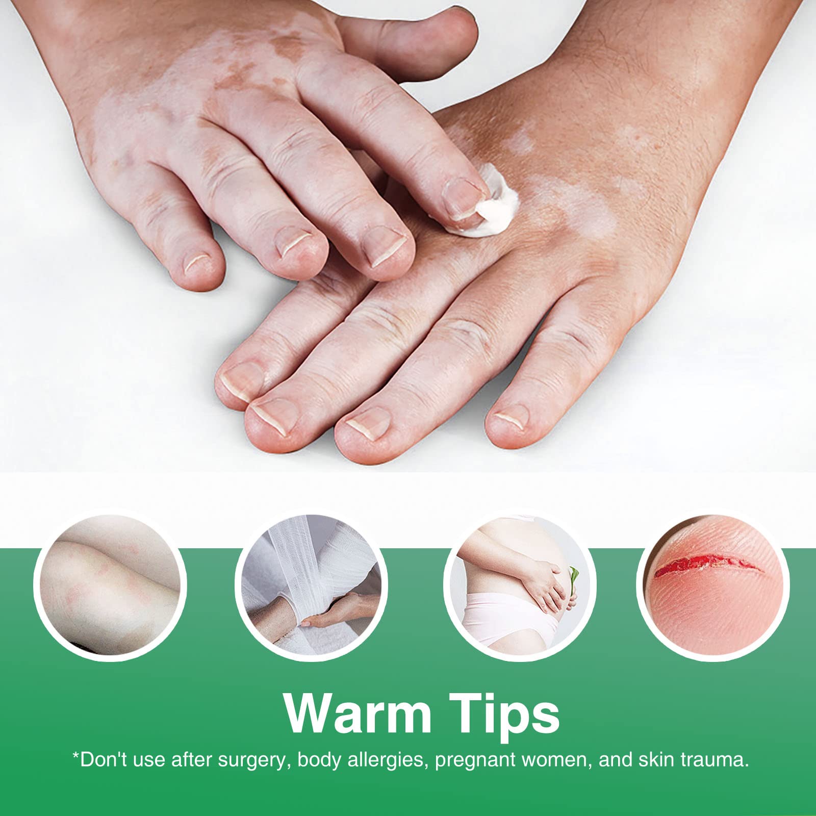 Richie House Vitiligo Cream packaging — premium care in a discreet tube.