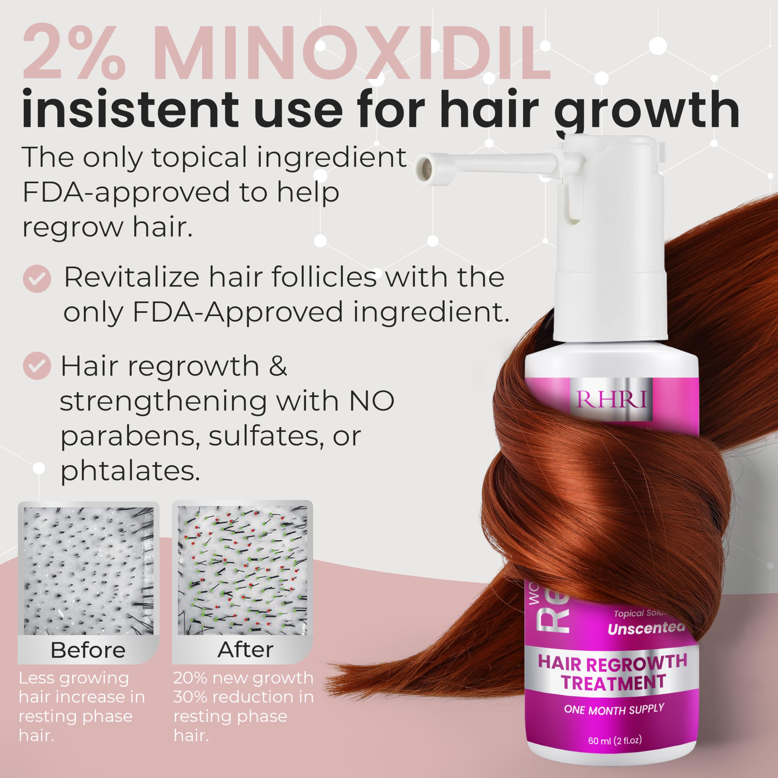 Rida Hair Minoxidil spray label close-up for reliable topical solution.