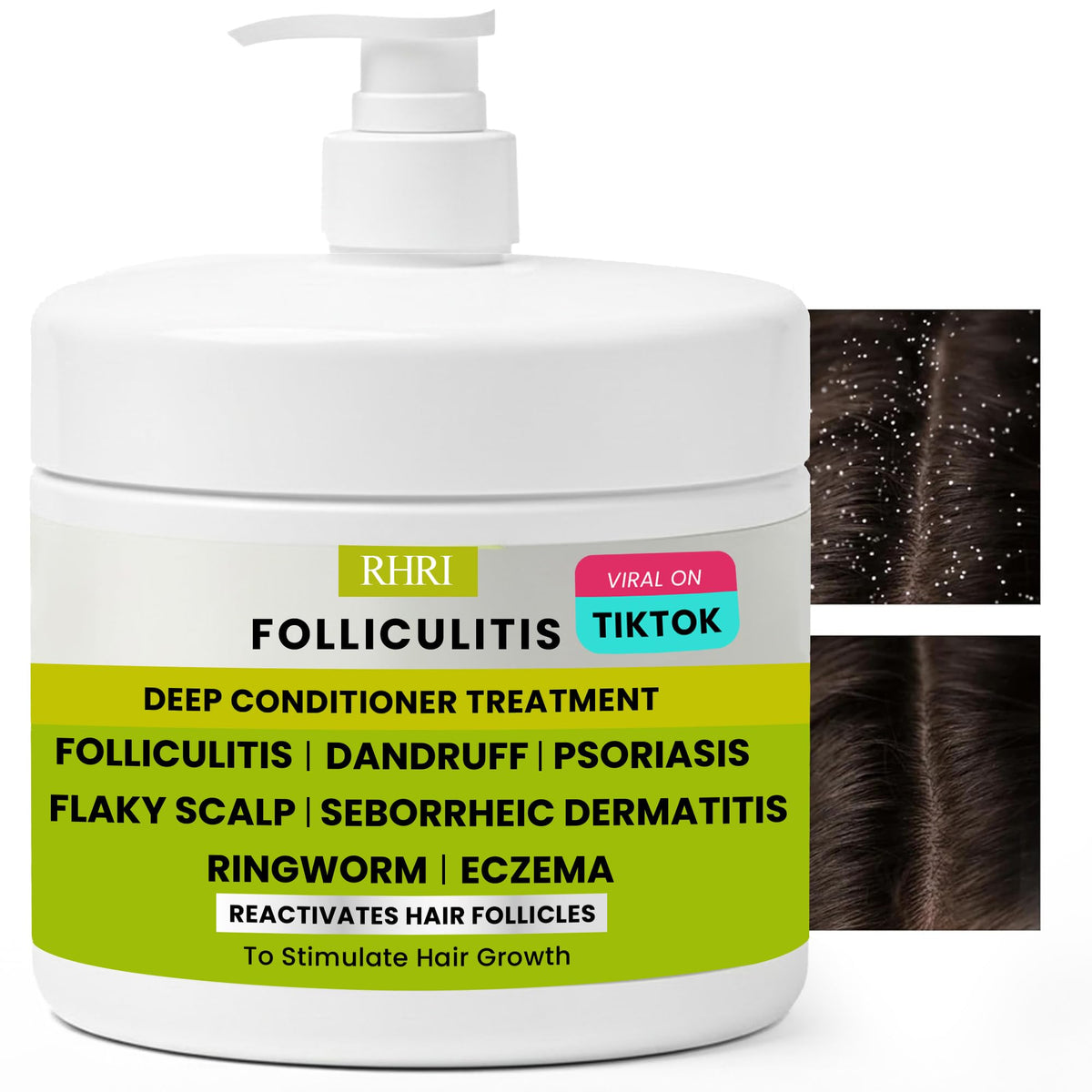 Rida Hair Folliculitis Deep Conditioner bottle for scalp hydration and comfort.