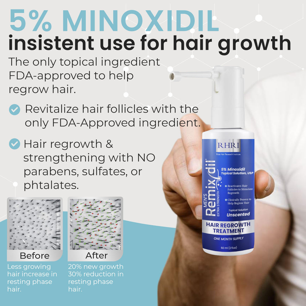 Rida Hair Minoxidil scalp application on thinning areas
