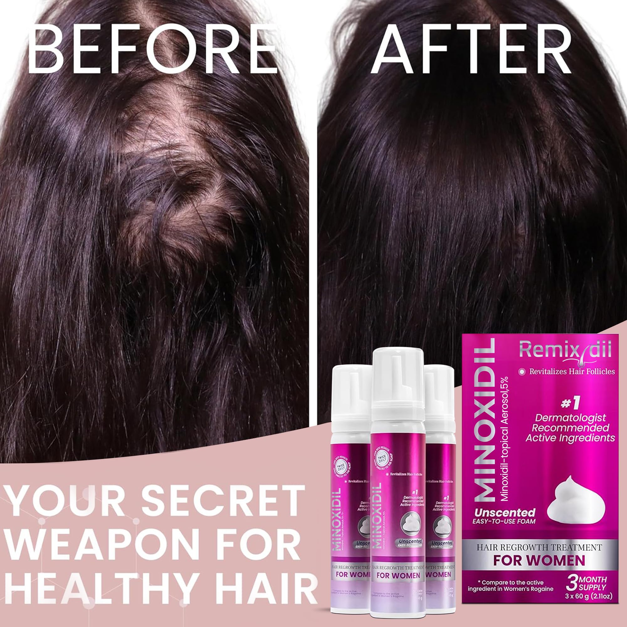 Rida Minoxidil visual journey hints at possible density gains.