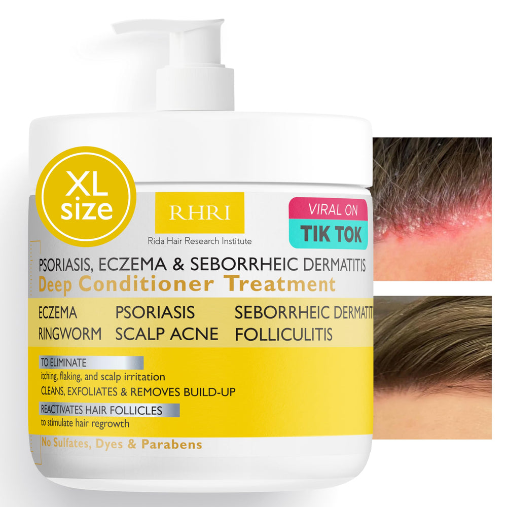 Rida anti fungal psoriasis conditioner bottle with tea tree oil soothing scalp