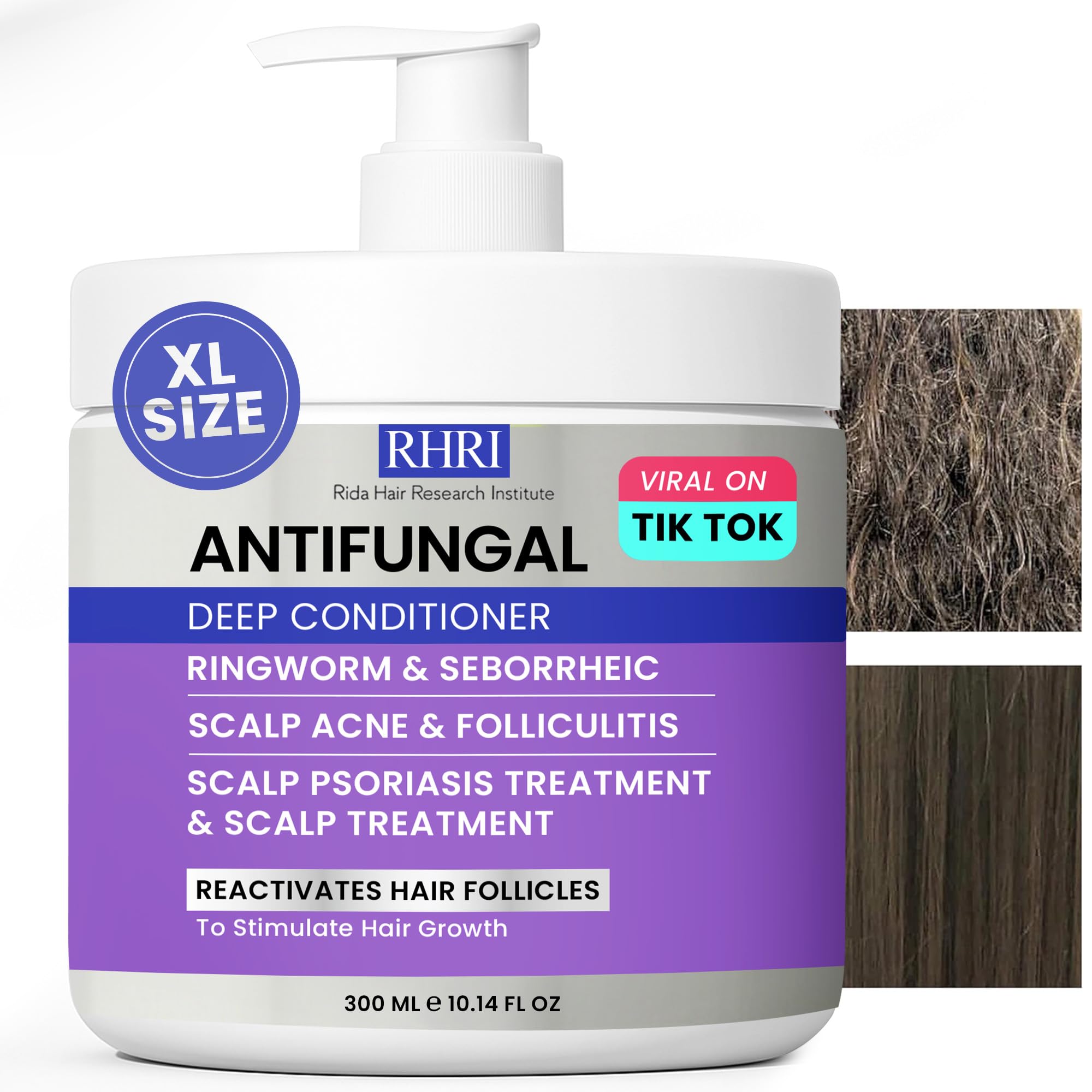 Rida Hair Research Institute antifungal deep conditioner bottle front for itchy scalp relief.