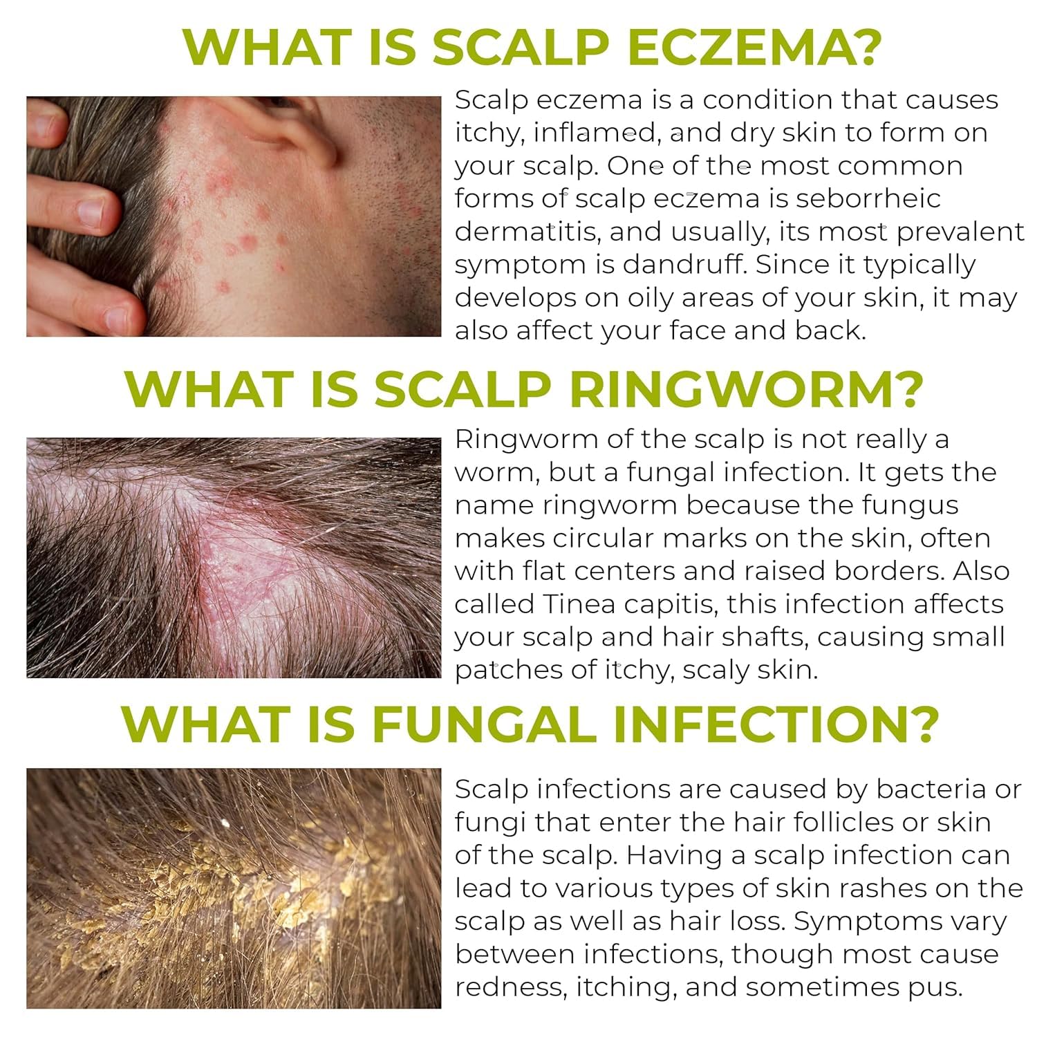 Rida Folliculitis Shampoo foam forms into a gentle lather on scalp.
