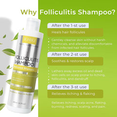 Rida Folliculitis Shampoo with herbal extracts supports scalp health.
