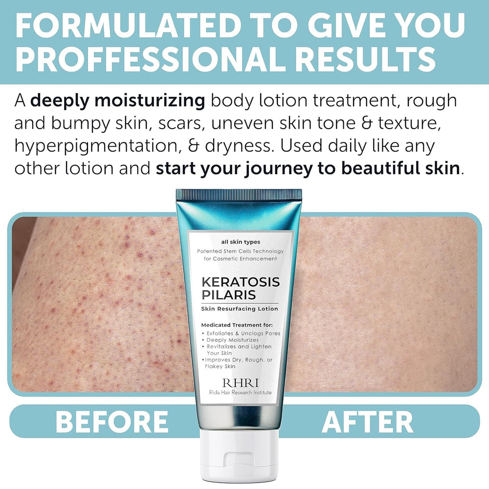 Rida KP Bump Eraser includes glycolic acid for skin renewal