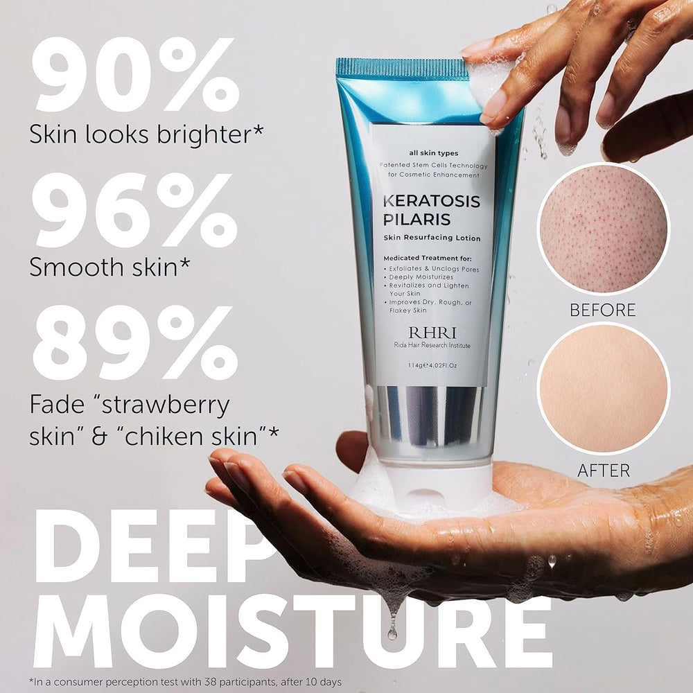 Rida KP Bump Eraser jar showing exfoliating texture for KP care