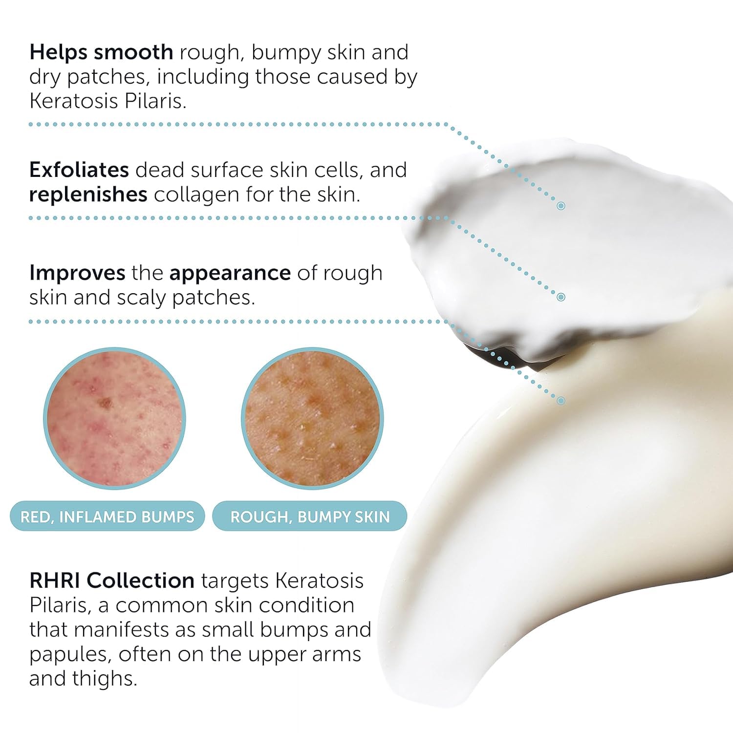 Rida KP Bump Eraser Lotion bottle for gentle exfoliation and softer texture.