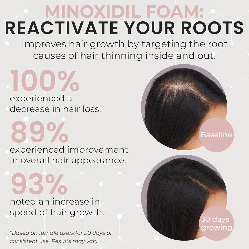 Rida Minoxidil foam applied to the scalp for thinning areas.