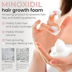 Rida Minoxidil foam on scalp closeup highlighting quick absorption.