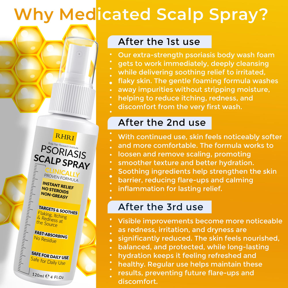 Rida Scalp Spray on scalp image showing even coverage.