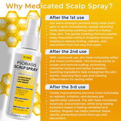 Rida Scalp Spray on scalp image showing even coverage.