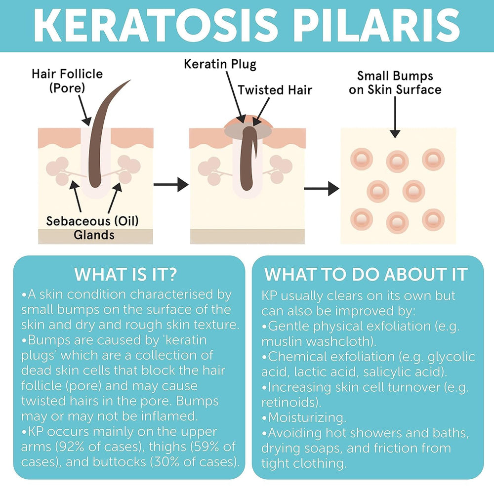 Rida Hair Keratosis Pilaris Treatment sleek packaging design on shelf.