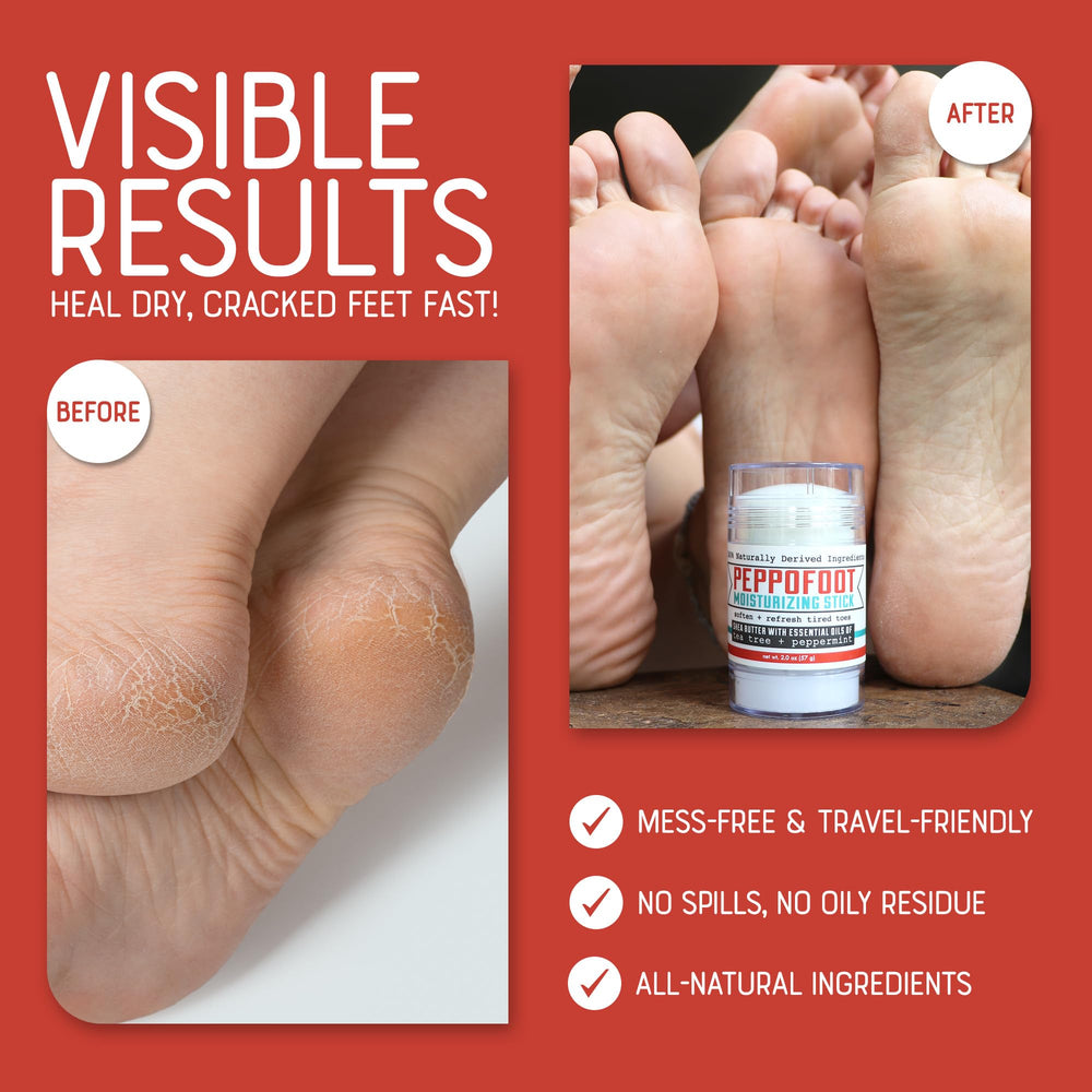 Portable Peppofoot Heel Balm Stick fits easily in a purse for travel use