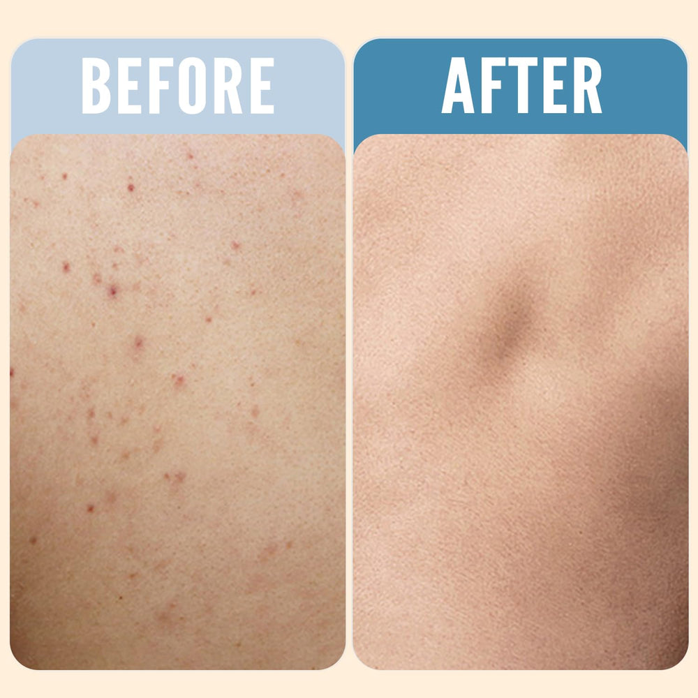 Rinse and Robust exfoliating bar with sea salt and charcoal for smoother skin.