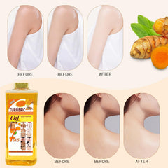 Rliolouo Soft 7 turmeric oil application enhances skin radiance