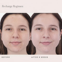 Recharge cleanser bottle application shot suggesting makeup removal and cleansing