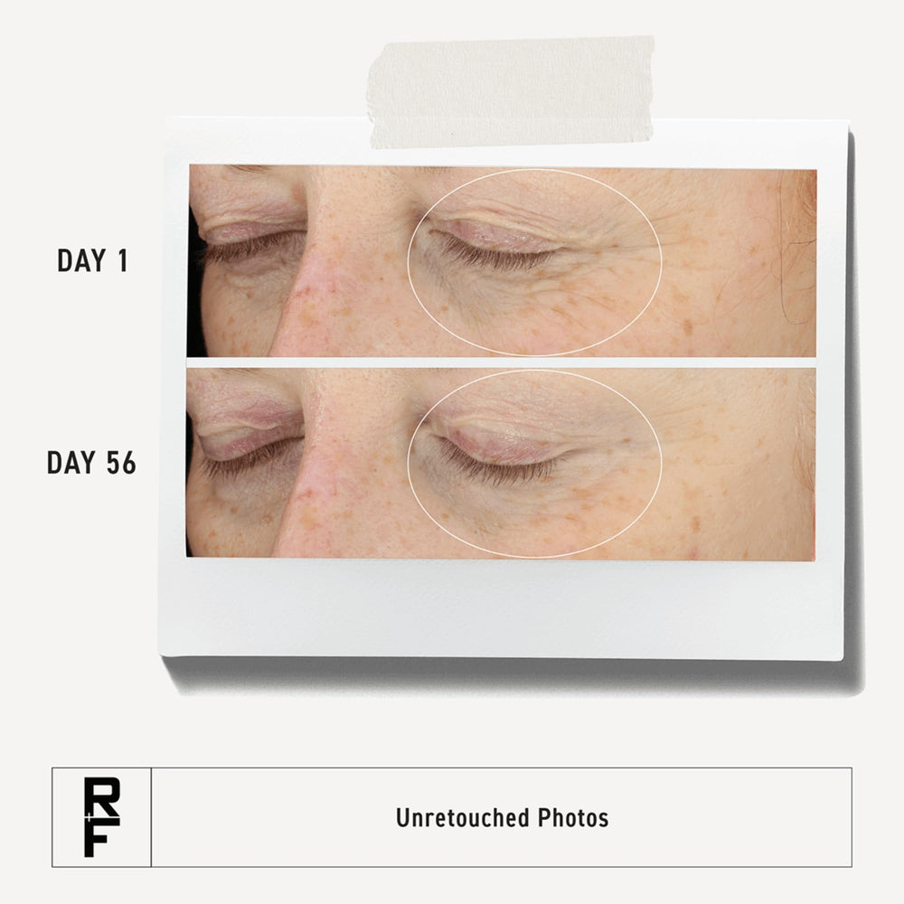 Close-up of Rodan + Fields Redefine Eye Cream texture showing creamy, nourishing formula