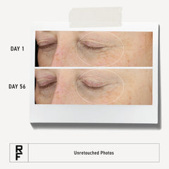 Close-up of Rodan + Fields Redefine Eye Cream texture showing creamy, nourishing formula