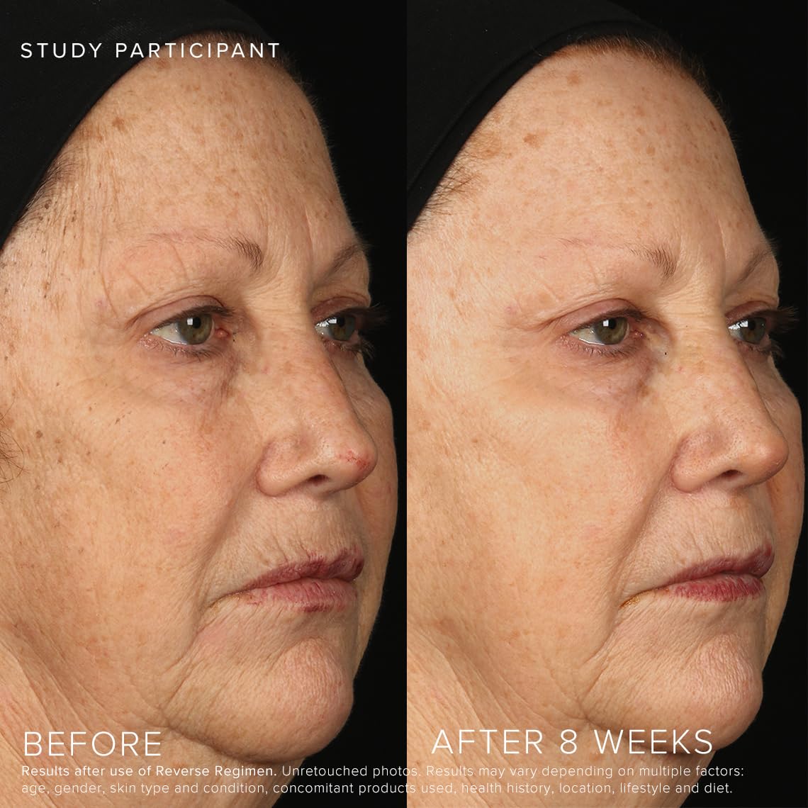 Rodan + Fields Reverse serum being applied to skin for brightness and improved texture.