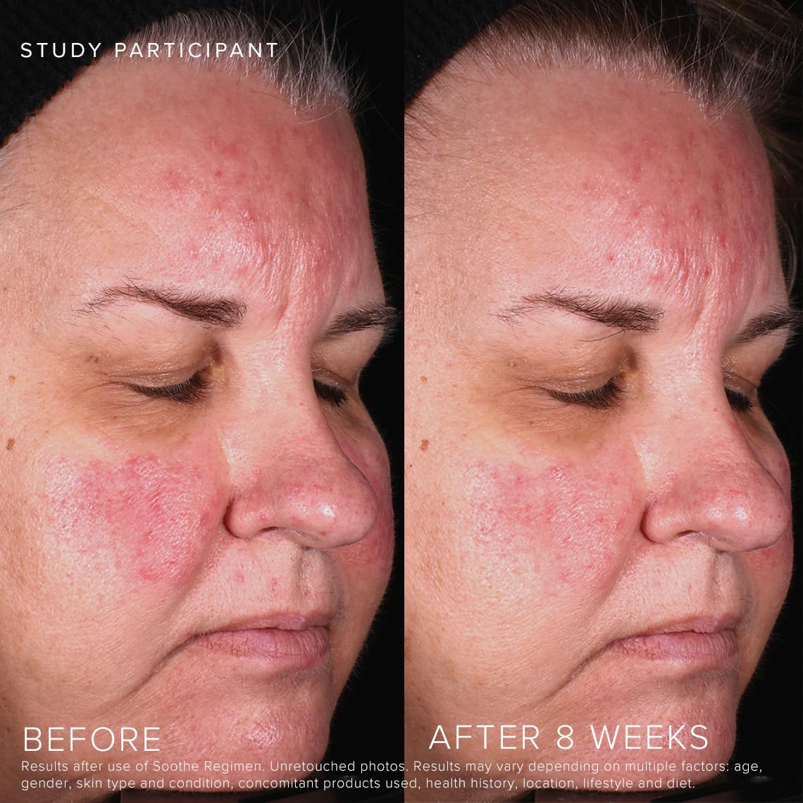 Rodan + Fields Soothe Calming Gel Cleanser hands applying to face for refreshing cleanse.