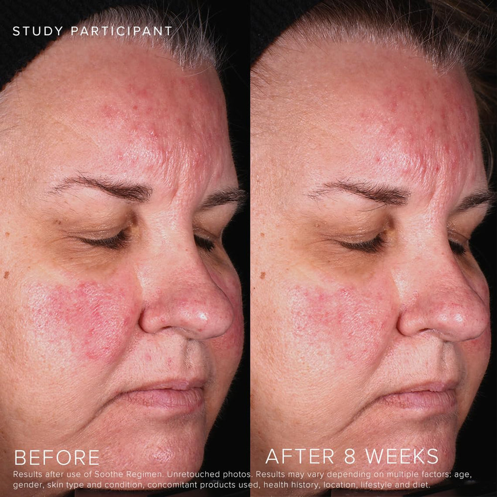 Rodan + Fields Soothe Calming Gel Cleanser hands applying to face for refreshing cleanse.