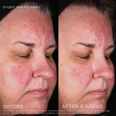 Rodan + Fields Soothe Calming Gel Cleanser hands applying to face for refreshing cleanse.